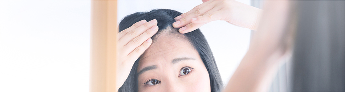 女性の薄毛治療ならdクリニック大阪 ウィメンズの女性頭髪専門外来