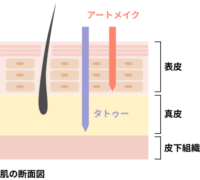 アートメイクと刺青（入れ墨）の違い