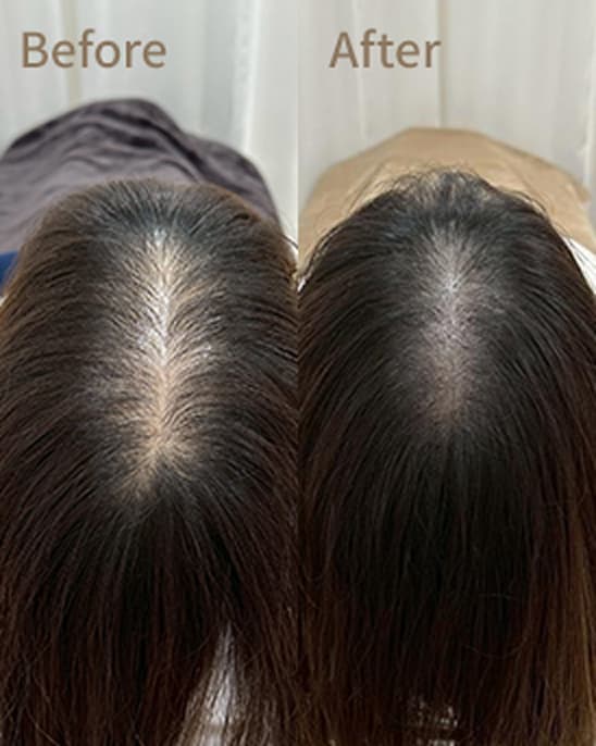 Before After CRE-ART クレアクレアート