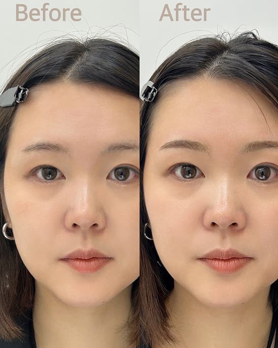 Before After CRE-ART クレアクレアート