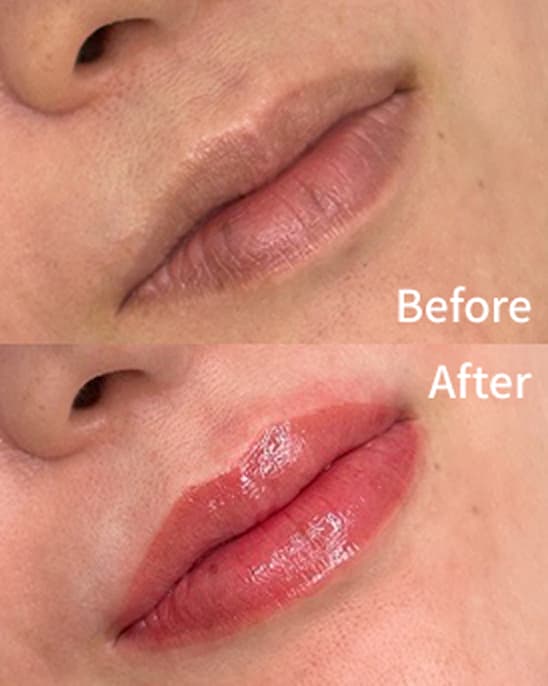 Before After CRE-ART クレアクレアート