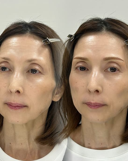 Before After CRE-ART クレアクレアート