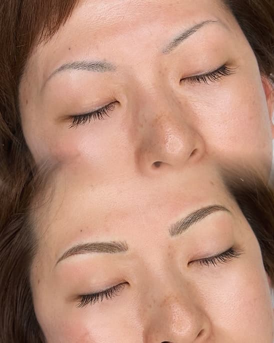 Before After CRE-ART クレアクレアート