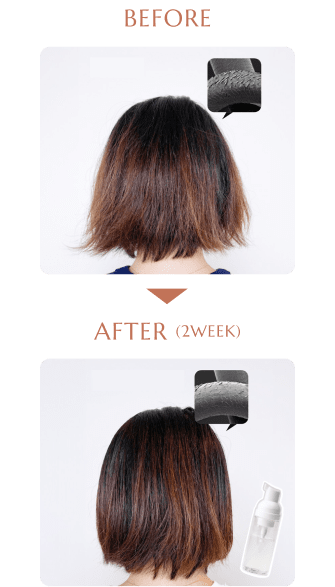 ヒアルロン酸トリートメントの補修効果 before・after(2週間後)