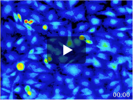 K+チャネル開口の反応（ミノキシジルのみ） 動画サムネイル