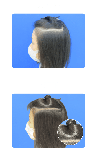 美髪治療の症例写真 before・after