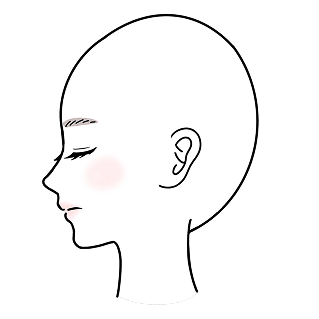 円形脱毛症 汎発型 イメージイラスト